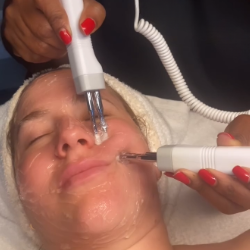 Dermaplaning Facial